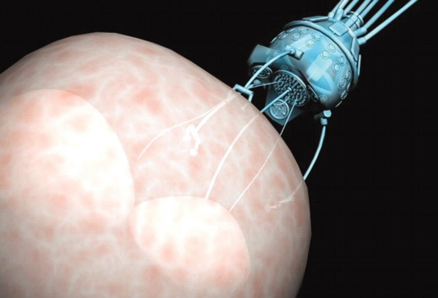 Newly developed microscopic robots, inspired on bacteria, will be able to perform small surgeries thanks to their flexibility and softness. Photo credit: Nanotechnology News Network / Yale Scientific