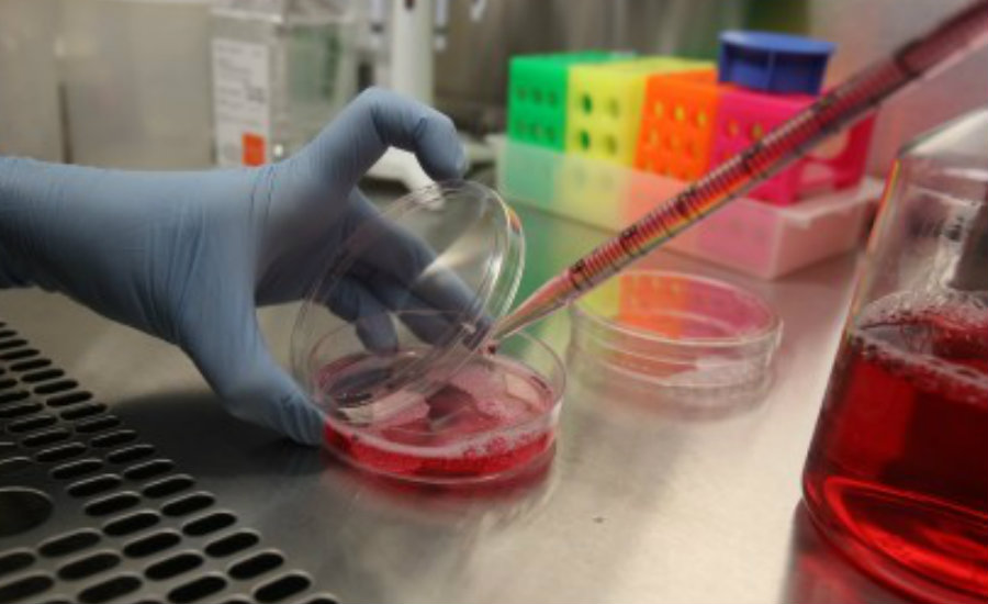 People suffering from sickle cell disease are hopeful for UAB Stem Cell Institute's advances on a cure to fight the disease. Image Credit: Alabama News