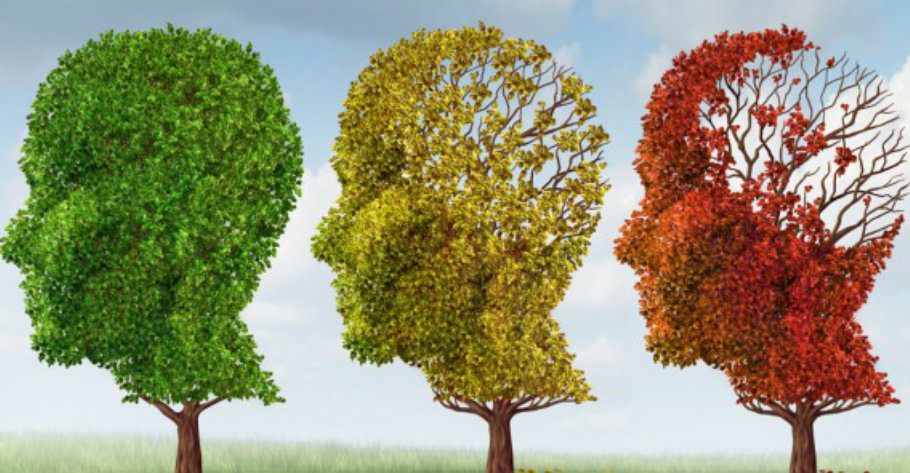 Alzheimer’s disease is a chronic neurodegenerative disease. It is the cause of almost 70% of dementia cases worldwide. Image Credit: Live Science