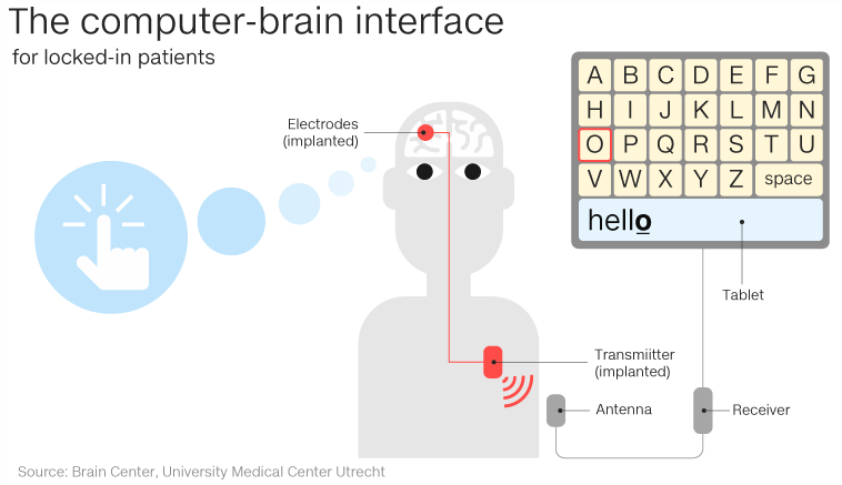 brain interface