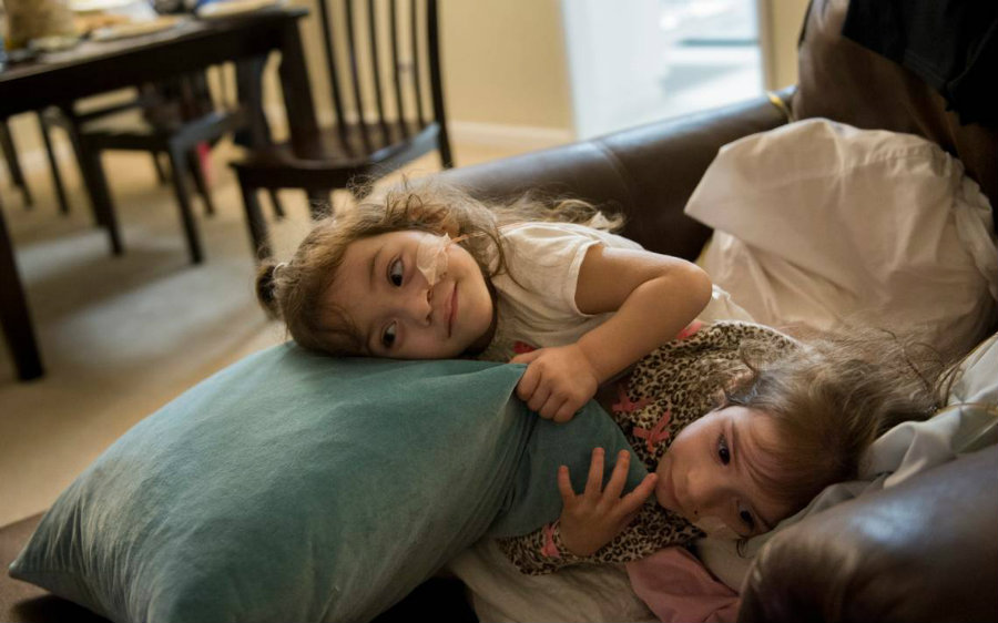 Eva and Erika Sandoval are finally two separate toddlers. Photo credit: Sacbee / Pekker Health