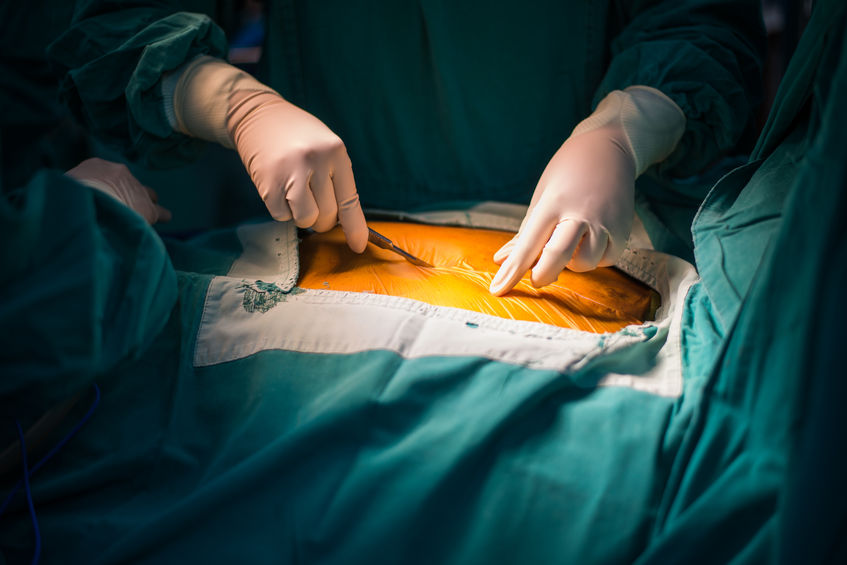 Gastric Bypass Surgery Might Have Long Lasting Negative Effects