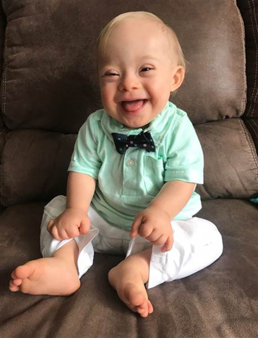 Gerber use a child with Down Syndrome as its image, Down baby Lucas Warren as Gerber Spokesbaby