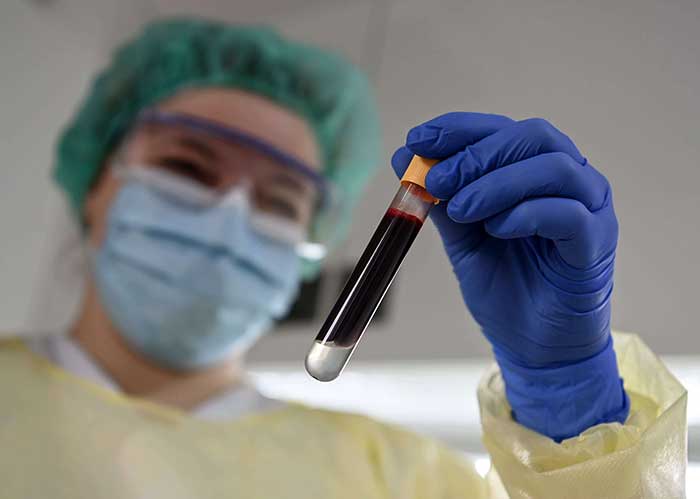 Galleri Test for Blood Detects Early Cancers in Patients Who Have No Symptoms