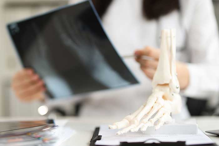 Have You Suffered Broken Bones From An Accident? How A Lawyer Can Help